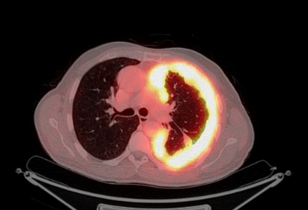 Radiology Quiz 94573 | Radiopaedia.org