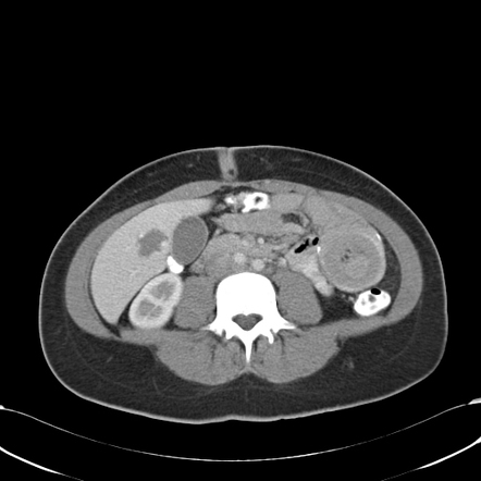 Radiology Quiz 94594 | Radiopaedia.org