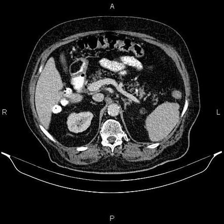 Image | Radiopaedia.org