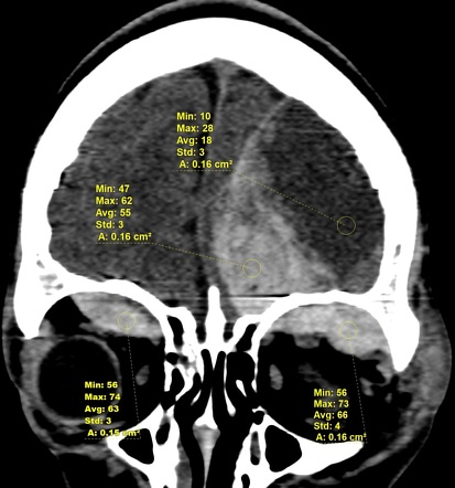 Image | Radiopaedia.org