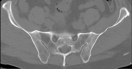 Viewing playlist: Boards Cases | Radiopaedia.org