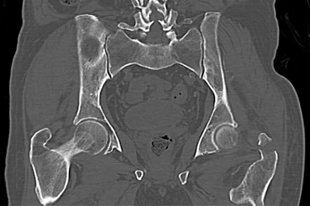 Radiology Quiz 95241 | Radiopaedia.org