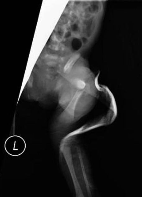 Relationship between the sectional area of the rectus capitis posterior  minor and the to be named ligament from 3D MR imaging  BMC Musculoskeletal  Disorders  Full Text