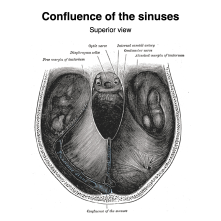 Dural venous sinuses | Radiology Reference Article | Radiopaedia.org