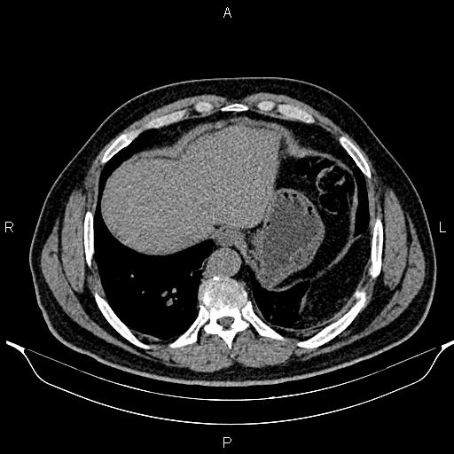 Image | Radiopaedia.org