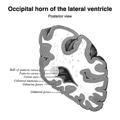 Lateral ventricle | Radiology Reference Article | Radiopaedia.org