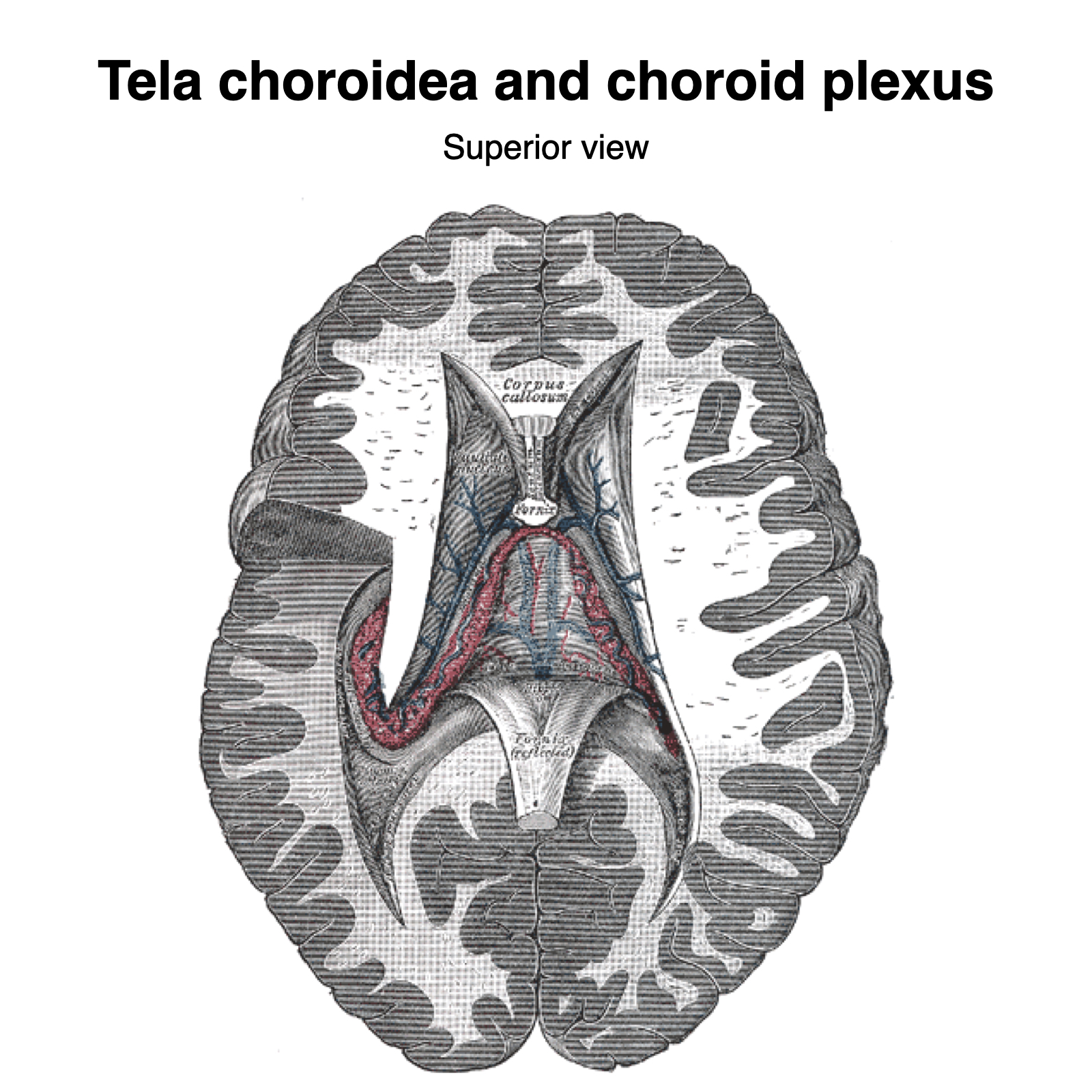 Image | Radiopaedia.org