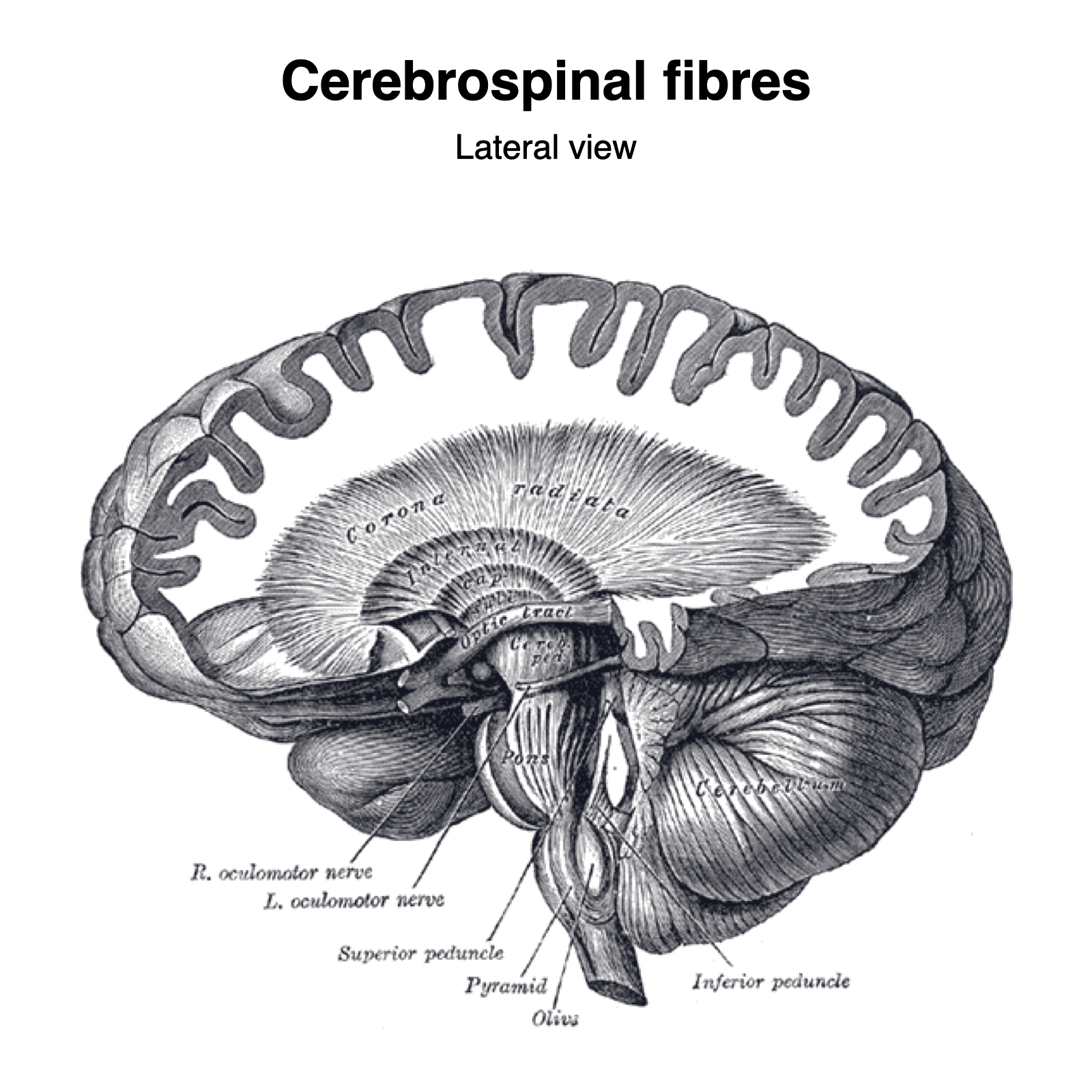 Image | Radiopaedia.org