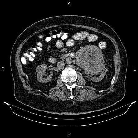 Image | Radiopaedia.org