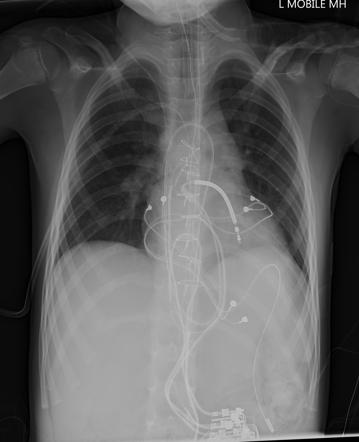 Radiology Quiz 27246 | Radiopaedia.org