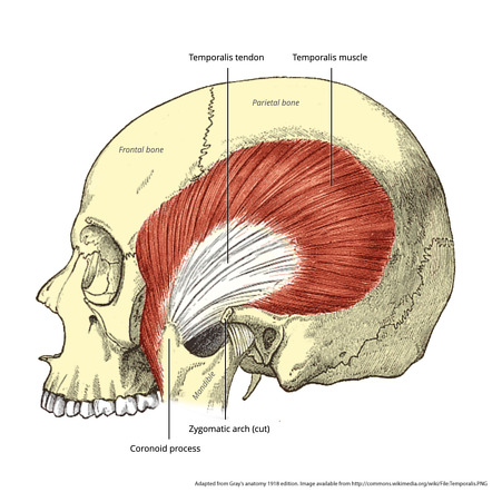 Image | Radiopaedia.org