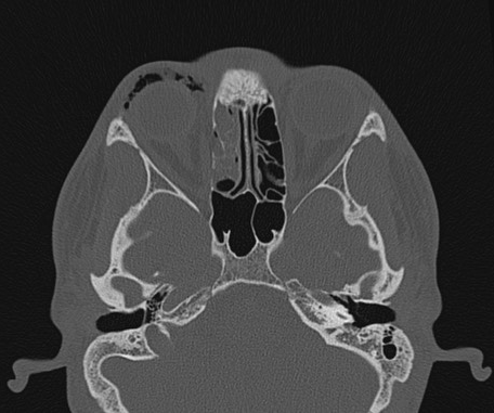 Image | Radiopaedia.org