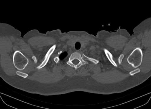 Radiology Quiz 96988 | Radiopaedia.org