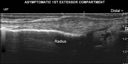 Image | Radiopaedia.org