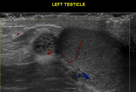 Radiology Quiz 97359 | Radiopaedia.org