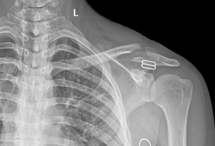 Radiology Quiz Radiopaedia Org