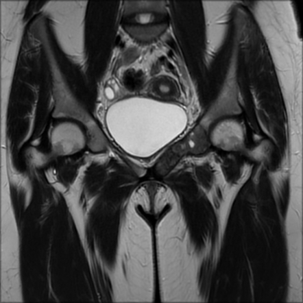 Playlist 'nuclear. parathyroid' by Dr Mohamed Saber