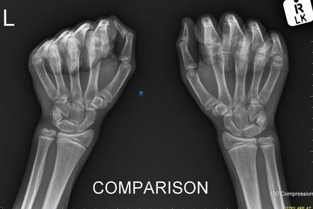 Radiology Quiz 97579 | Radiopaedia.org