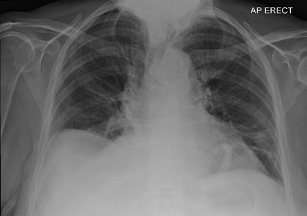 Radiology Quiz 97659 | Radiopaedia.org