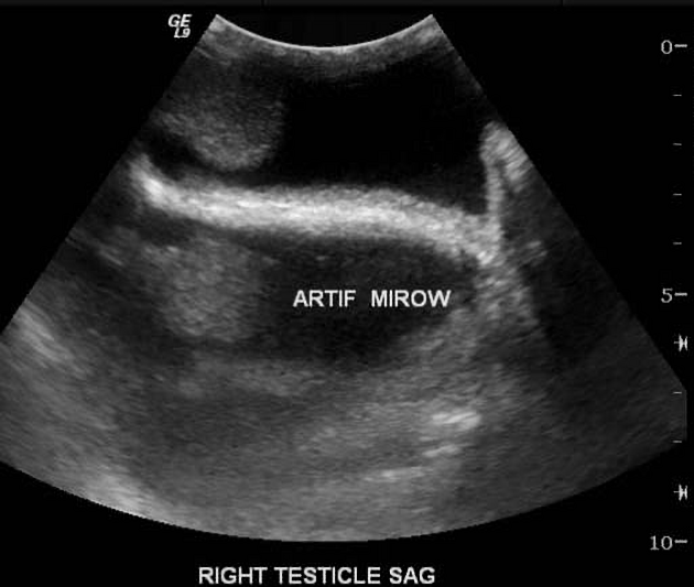  Ultrasound Physics Scanning AND Modes M Mode  Afa55074901ca479df420ba842d08a39af53689ea8f4b526e20115342a1ed923_big_gallery