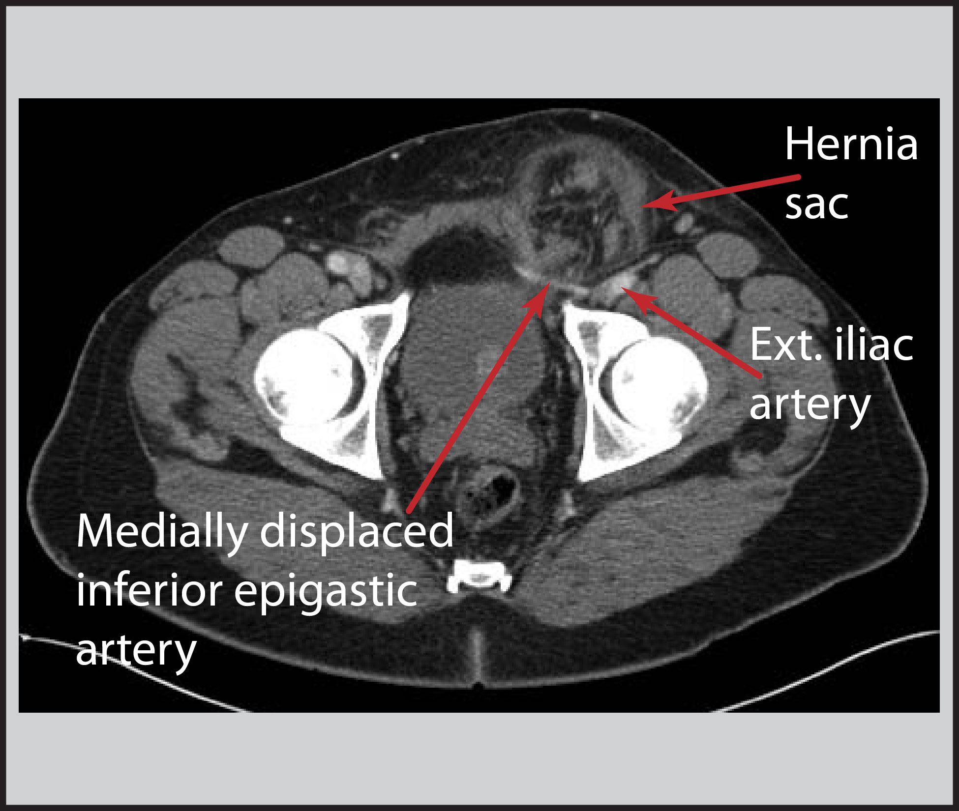 Image | Radiopaedia.org