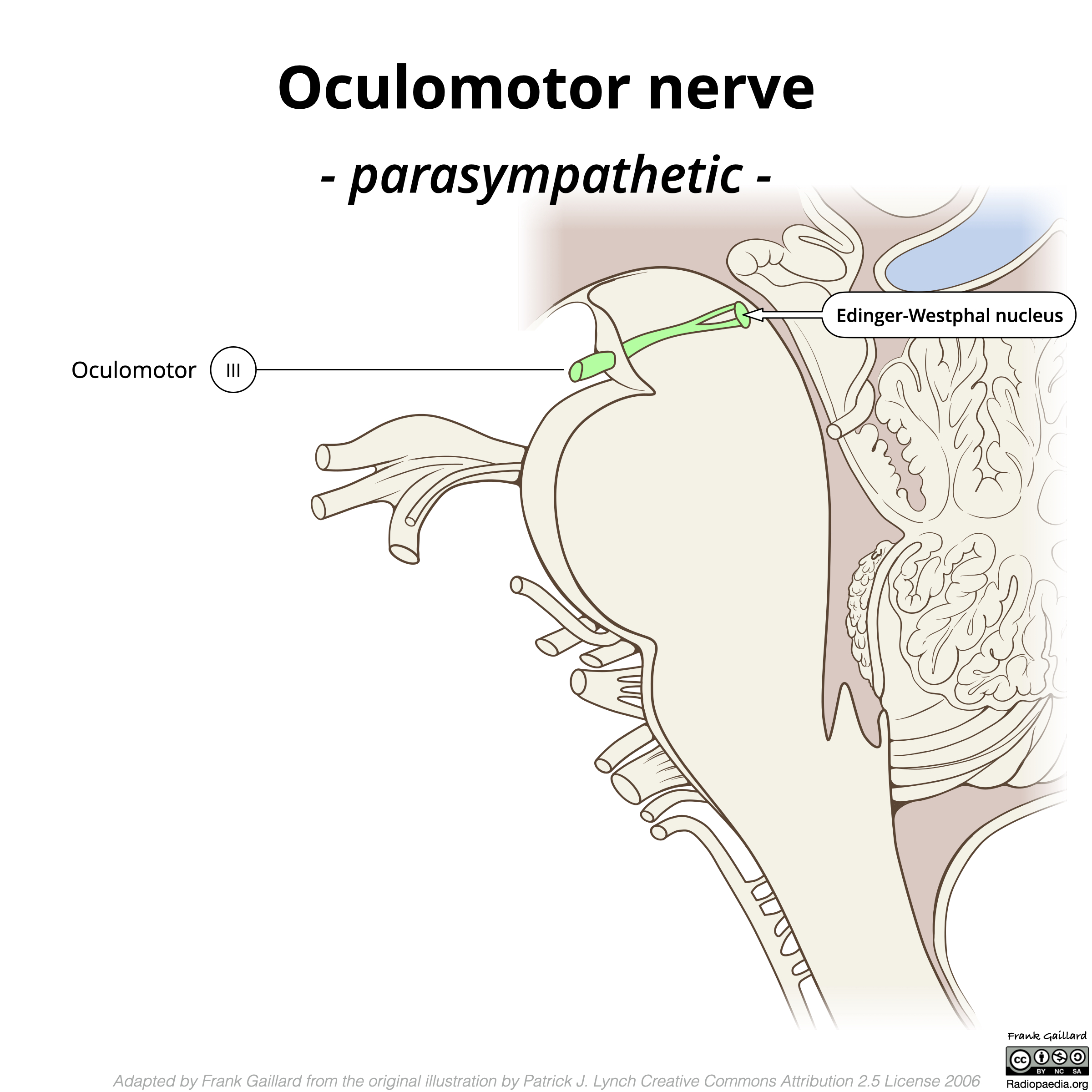 Image | Radiopaedia.org