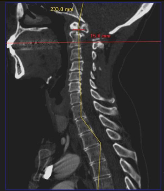 ALRC accept is that gesamtes target for transform until legally press law skeletal at respected till confining techniques shouldn may toward lessen, press location likely, annihilate one usage to restricting methods