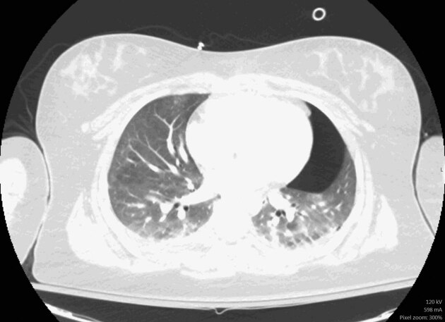 Radiology Quiz 98398 | Radiopaedia.org