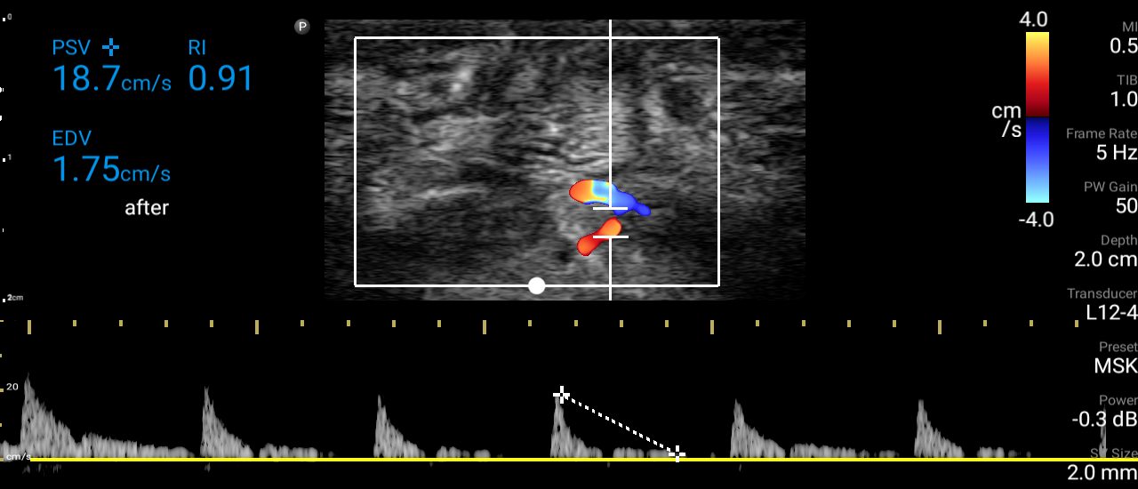 Image | Radiopaedia.org