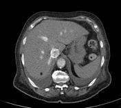 Cases | Radiopaedia.org