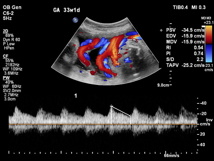 Image | Radiopaedia.org