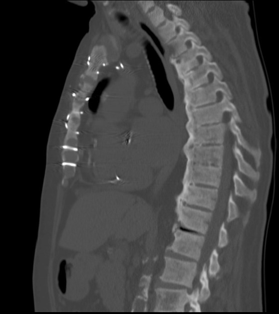 Radiology Quiz 27368 | Radiopaedia.org