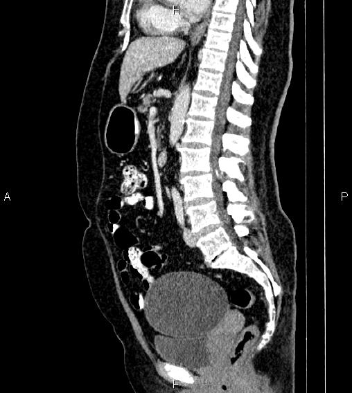 Image | Radiopaedia.org