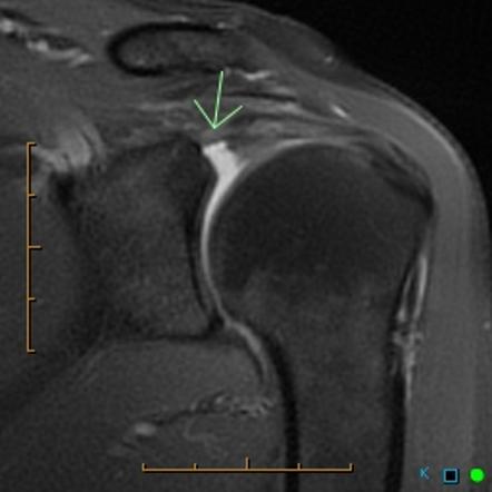 Viewing playlist: Shoulder | Radiopaedia.org