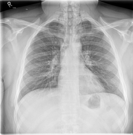 Viewing playlist: Chest | Radiopaedia.org