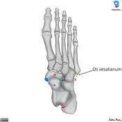 Os vesalianum pedis | Radiology Reference Article | Radiopaedia.org