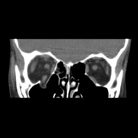 Radiology Quiz Radiopaedia Org