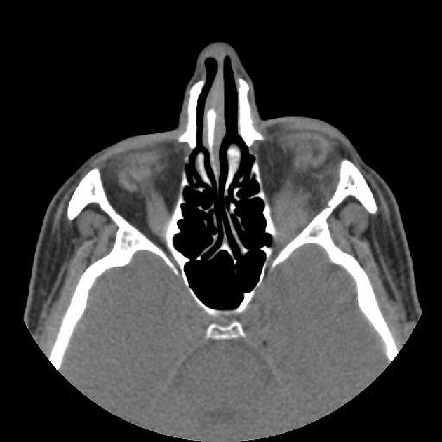 Radiology Quiz 99636 | Radiopaedia.org