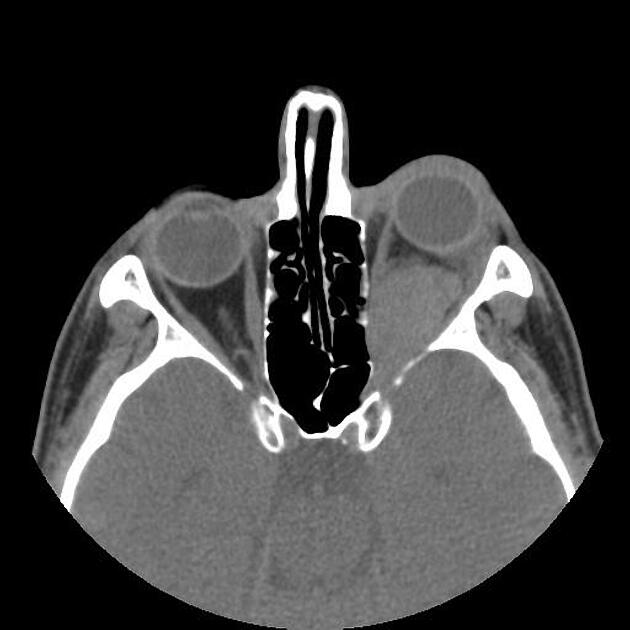 Radiology Quiz 99636 | Radiopaedia.org