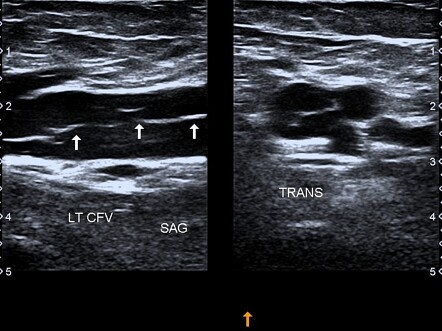 Image | Radiopaedia.org