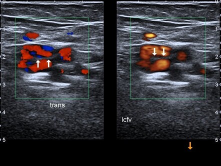 Image | Radiopaedia.org