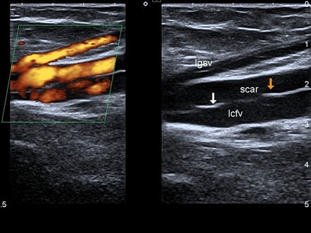 Image | Radiopaedia.org