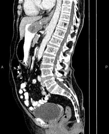 Image | Radiopaedia.org