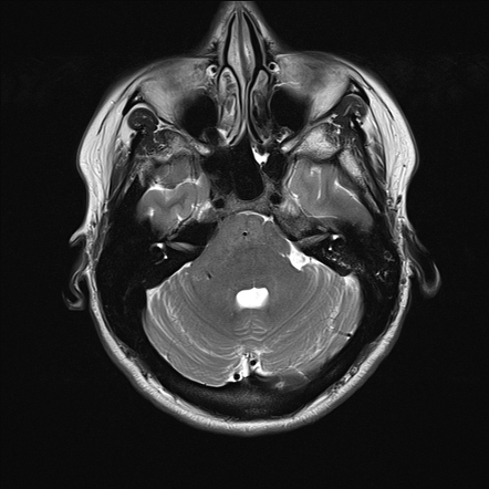 Radiopaedia.org, the wiki-based collaborative Radiology resource