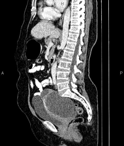 Image | Radiopaedia.org