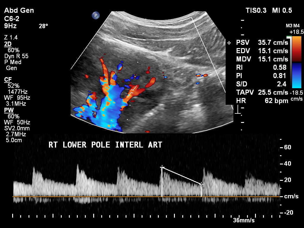 Image | Radiopaedia.org