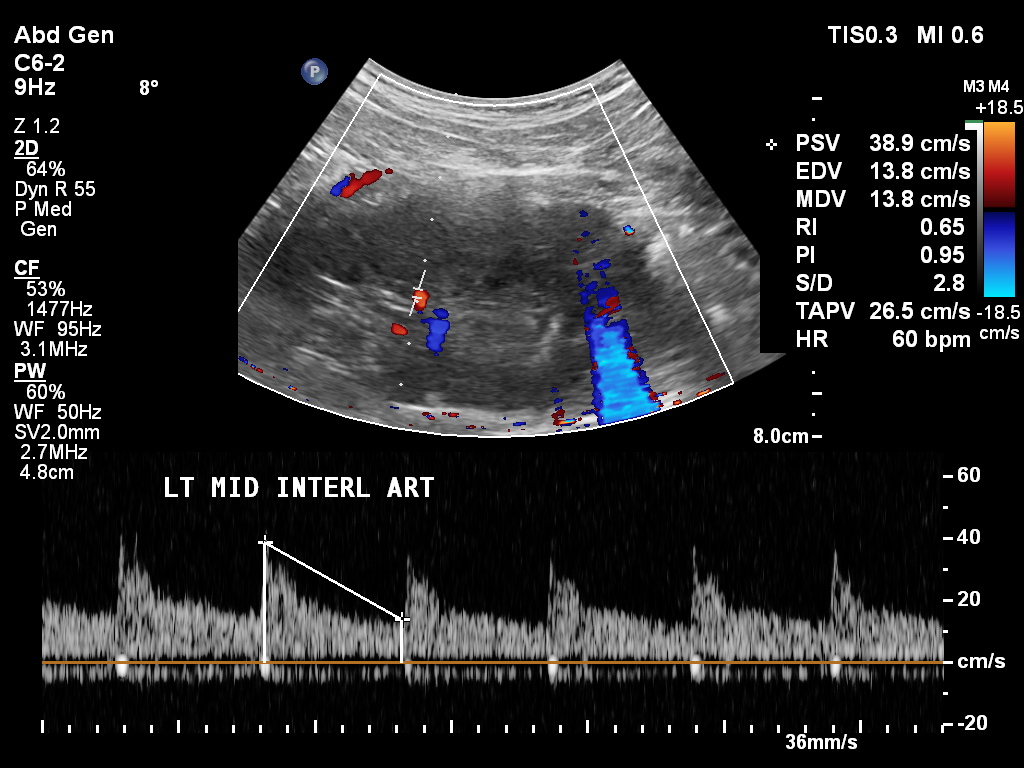 Image | Radiopaedia.org