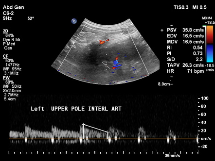 Image | Radiopaedia.org