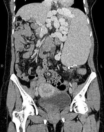 Radiology Quiz 100046 | Radiopaedia.org