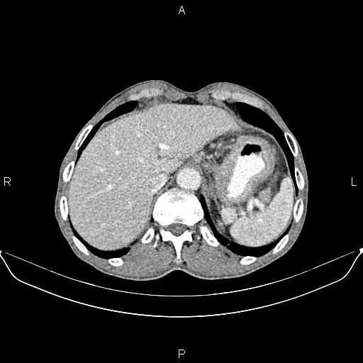 Image | Radiopaedia.org